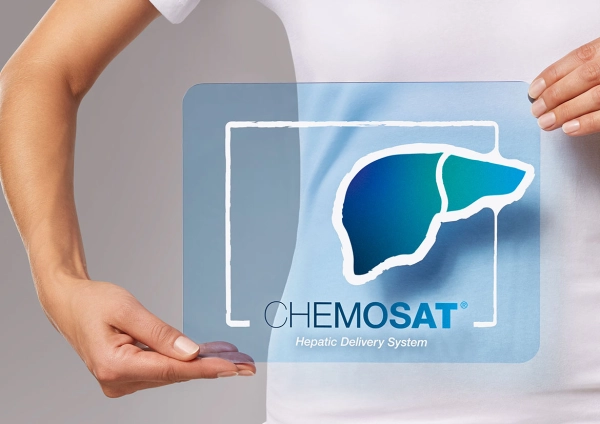 CHEMOSAT® System zur gezielten Melphalan-Perfusion bei Leberkrebs